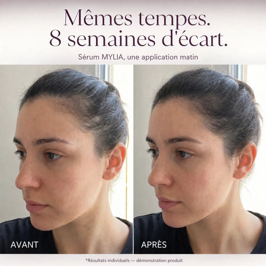 Sérum Capillaire Anti-Chute et Repousse pour Mamans - Mylia Care