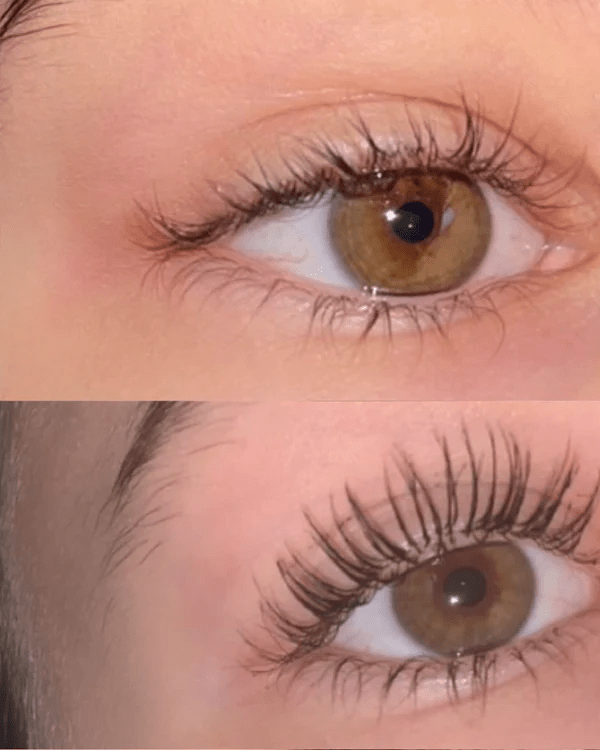 Des cils plus long et dense en 4 semaines - Mylia Care