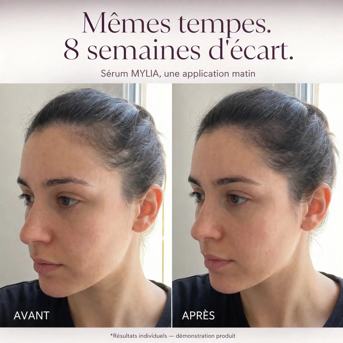 Sérum Capillaire Anti-Chute et Repousse pour Mamans - Mylia Care