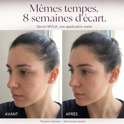 Sérum Capillaire Anti-Chute et Repousse pour Mamans - Mylia Care